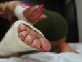 MASTURBATION HAVING SPRAINED ANKLE AND HAND . YelahiaG