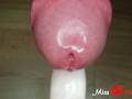 Close up amateur femdom ruined orgasm with urethral sounding. Frenulum stimulation