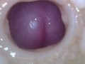 Super cum in vagina. Excellent internal camera