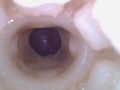 Super cum in vagina. Excellent internal camera