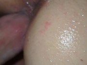 Stretched out pussyStretched out pussy