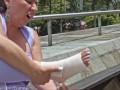 SPRAIN ANKLE & SELF FOOT WORSHIP . YELAHIAG