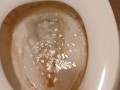 Toilet Pissing
