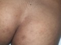 Husband Massage Wife Pussy And Ass Hole And Spread More