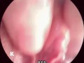 【解剖生理学】超小型カメラで元看護師の私が膣内を観察し紹介します。