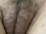 更多yp25.cc 毛毛逐渐长出来啦！！！