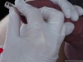 Perfect extraction of sperm directly from the urethra. Close-up of the glass straw sounding.