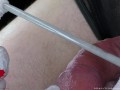 Perfect extraction of sperm directly from the urethra. Close-up of the glass straw sounding.