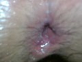 Milf whore fucked ass extreme anal filled with cum creampie