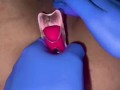 Pussy care  gynecologist speculum examination brought me to orgasm fluid examination