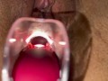 Pussy care  gynecologist speculum examination brought me to orgasm fluid examination