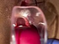 Pussy care  gynecologist speculum examination brought me to orgasm fluid examination