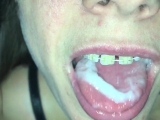 Cum play with retainer.