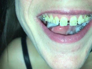 Cum play with retainer.