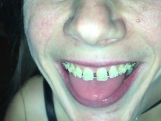 Cum play with retainer.