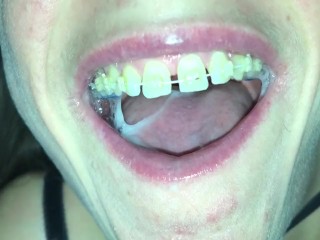 Cum play with retainer.