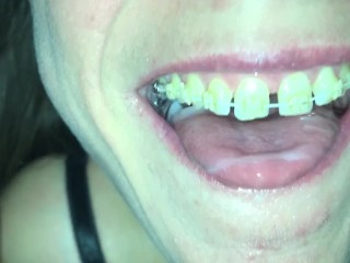 Cum play with retainer.