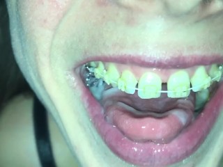 Cum play with retainer.