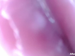 Camera Inside Real Vagina Before & After Creampie - Cervix POV