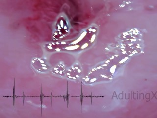 Cervix Pulse Heartbeat Orgasms EKG - Sophie Adulting