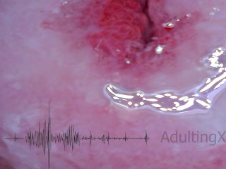 Cervix Pulse Heartbeat Orgasms EKG - Sophie Adulting