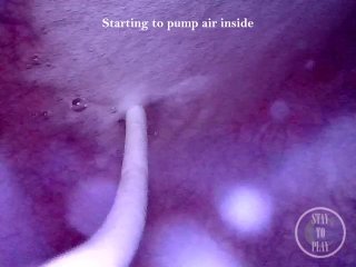 INSIDE POV: Inflating my Bladder with Air - Preview