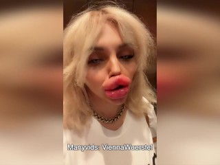 Biggest fake Lips on the WORLD