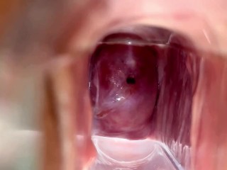 Cervix Closeup Using Speculum - See Inside Her Pussy