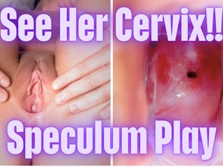 Cervix Closeup Using Speculum - See Inside Her Pussy