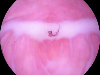 Camera goes Deep Inside Wet Pussy. Close up Cervix!