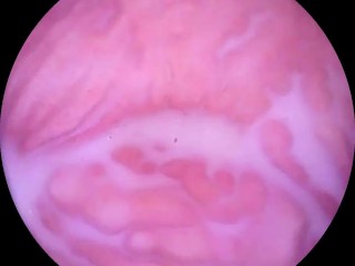 Camera goes Deep Inside Wet Pussy. Close up Cervix!