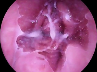 Camera goes Deep Inside Wet Pussy. Close up Cervix!