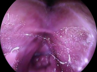 Camera goes Deep Inside Wet Pussy. Close up Cervix!