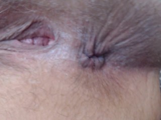 Extreme Closeup Asshole Hairy Blue Fingernails