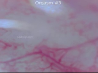 Camera Inside Ass, 9 Throbbing Pulsing Anal Orgasms,  Live Stethoscope Heartbeat - Full Clip