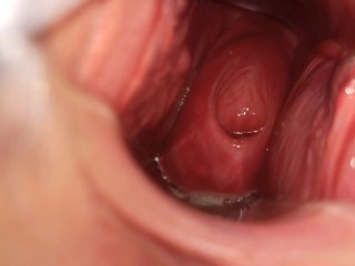 I like to show my cervix