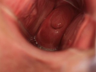 I like to show my cervix