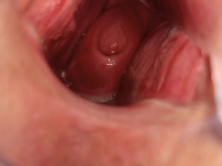 I like to show my cervix