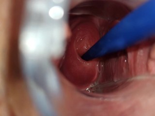 I like to show my cervix