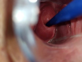 I like to show my cervix