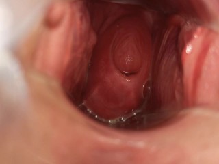 I like to show my cervix