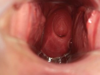 I like to show my cervix