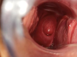 I like to show my cervix