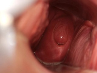 I like to show my cervix