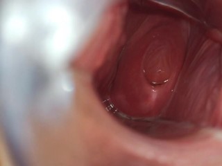 I like to show my cervix