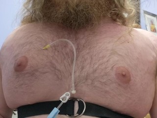 N2O Chest Inflation (fast forward)