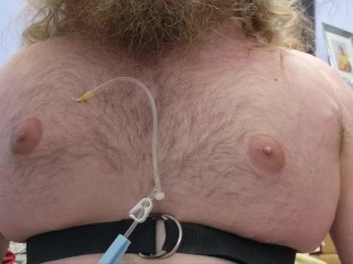 N2O Chest Inflation (fast forward)