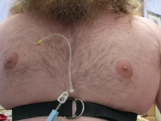 N2O Chest Inflation (fast forward)