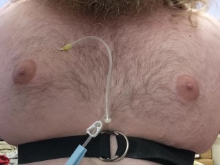 N2O Chest Inflation (fast forward)