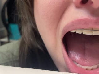 Retainer Mouth Closeup (PREVIEW)